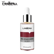 FenHuan 1PC Fungus Nail Repair Soothing Anti-inflammatory Athletes Foot Real Customer Reviews Foot T