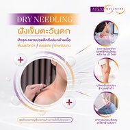[E-Voucher] APEX โปรแกรมฝังเข็มตะวันตก Dry Needling ลดอาการปวด ตึง เกร็ง ของกล้ามเนื้อ เลือก 1 จุด