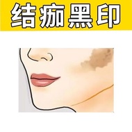 Behind Scabs Leaving Black Marks Melanin Precipitation Melanin Calm Skin Blackening Long Not Fade Bl