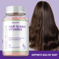 Hair Growth Gummies for Men and Women – Vegan Hair Growth Gummies with 5000 mcg of Biotin – Hair Vit