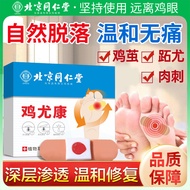 Chicken Eye Ointment Tongrentang Chicken Eye Patch Beijing Chicken Eye Callus Care Wart Callus Foot 