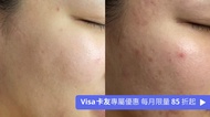 Overall Stylist 微晶藻針煥膚 90 min