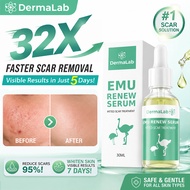 Dermalab Emu Renew Serum 30ml For All Skin Types Pitted Scar Treatment Moisturizing Scar Removal Cre