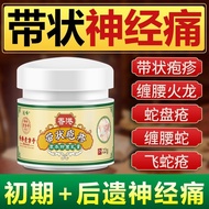 Hong post-herpes zoster neuralgia, snake disc sore, sna Hong Kong herpes zoster neuralgia neuralgia 