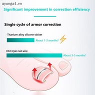 [Ayunga] 2Pcs Ingrown Toenail Corrector Tools Pedicure Recover Embed Toe Nail Ingrown Toenail Straig