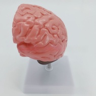 Human Brain Anatomy Brain/stroke Model Brain Disease Model Infarction Lesion Anatomy Model