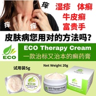 ECO Therapy Cream 皮肤癣膏【湿疹/ 牛皮癣/ 富贵手/ 股癣/ 大腿内则癣/ 毛囊炎】无类固醇 萬肤宜用 Eczema Psoriasis Cream 【Steroid Free for The Perfect Derma
