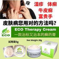 ECO Therapy Cream 皮肤癣膏【湿疹/ 牛皮癣/ 富贵手/ 股癣/ 大腿内则癣/ 毛囊炎】无类固醇 萬肤宜用 Eczema Psoriasis Cream 【Steroid Free f