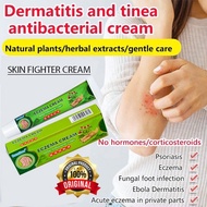 Psoriasis Ointment Eczema Cream Itchy Skin Cream Ointment for Itchy Skin And Allergy