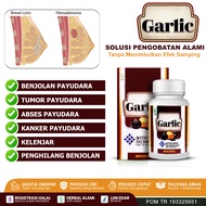 Obat Benjolan di Payudara Kanker Payudara Tumor Payudara Kelenjar Payudara Pengempis Benjolan Hilang