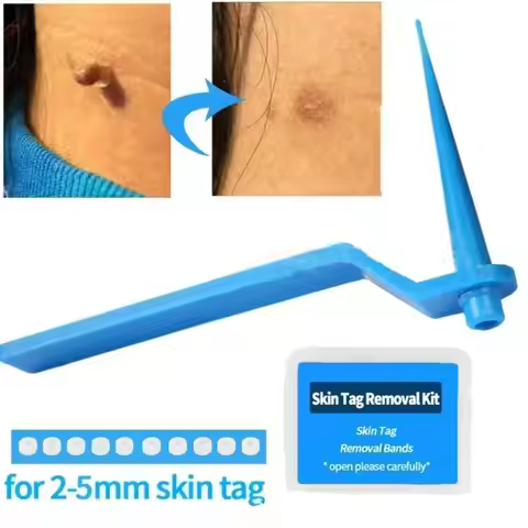 2 IN 1 Painless Auto Micro Skin Tag Removal Kit Adult Skin Tag Mole Wart Remover Face Cleaning Skin 