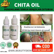Benjolan 7 Hari Langsung Hilang!! CHITA OIL Penghilang Benjolan Dan Gatal Gatal 100% Original | Oba