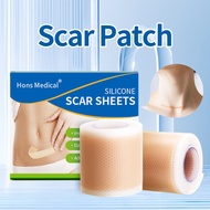 Silicone Scar Tape Medical Scar Sheet Silicone Scar Patch for Surgical , Keloid, C-Section, Burn
