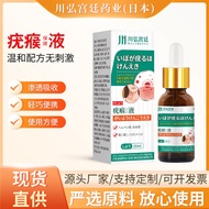 Chuanhong Palace Flat Wart Flat Ointment 正 A Feel Spirit Wart Remove Eugene Dedicated Root Chopping 