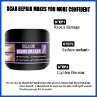 ✤ ◮ ═ EELHOE Original Scar Repair Cream for old scar stretch mark remover acne scar remover Aliver