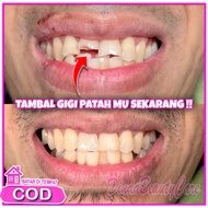 SANGAT KUAT !! TAMBAL GIGI PATAH Penambal Gigi Patah Setengah Permanen Gigi Palsu Penambal Gigi Pata