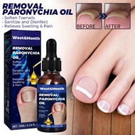 West&Month Ingrown Toenail Corrector Nail Helper Ingrown Toenail Corrector for Discomfort Relief