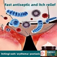 Itching Cream Private Part Anti Itch 30g pubic itch remedy slit shell itch parts Antifungal cream anti-itching