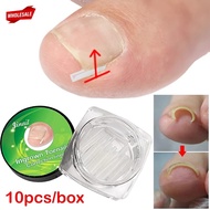 (BC)10Pcs Professional Ingrown Toenail Correction Tool / Ingrown Toenail Corrector Pad/Paronychia Co