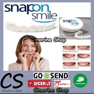 snap on smile venner gigi