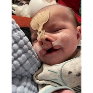 bayi cleft punye produk