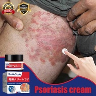 Psoriasis Cream Antifungal cream Eczema cream Cream gatal kulit 30g krim gatal kulit herba cina Ubat