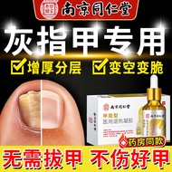 南京同仁堂药业灰指甲特殊去除增厚发黄变白变空脚趾甲萎缩灰指甲专用灰甲净指甲真菌感染脱甲坏甲制药生产