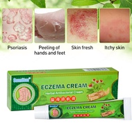 【Sumifun】Eczema Treatment Cream gamot sa kati kati sa balat buni Psoriasis Treatment Cream Eczema Oi