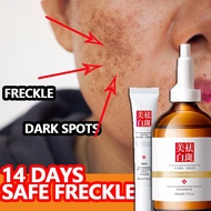【现货】美白祛斑霜Whitening Freckle Cream Krim jeragat Dark spot remover Freckles removal face cream freckles removal face cream