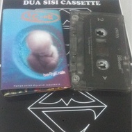 Scope Tape Cassette - Moving