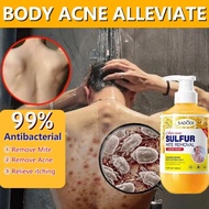 shower gel Anti Mite Acne body wash 500ml Sulfur relieves itching, removes acne and mites whitening 