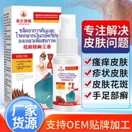 Spray Remove Itchy Skin Itchy King Itchy King Spray Anti-Itch Spray Poison King Itch External Use Li