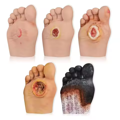Ultrassist Diabetic Foot Ulcer Grading Model 5 Stages Human Foot Diabetes Complication Simulator for