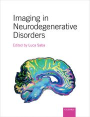 Imaging in Neurodegenerative Disorders Luca Saba