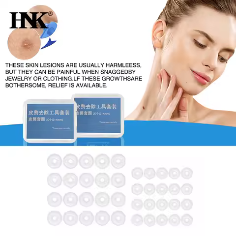 20Pcs Replacement Warts Rubber Ring Rubber Ring Tagband 0.5/1/1.5MM For Painless Skin Tag Mole Wart 