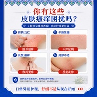 Ready Stock Quick Shipping Miaojiang Anti-itch Cream Anti-itch King Anti-itch Cream Skin Itching Ant