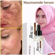 Serum Jeragat Anti Freckles Whitening Serum Muka Hydrating Facial Essence Moisturizer Hymeys Niacina