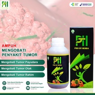 Obat Tumor Paling Ampuh Tumor Ganas Tumor Payudara Tumor Di Kepala Tumor Benjolan Tumor Jinak Tumor