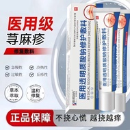 Straight Hair Eczema Cream Stubborn Eczema Eczema Eczema Eczema Eczema Itch Blisters Relieve Itchy S