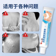 Skin Itching Cream Excellent Skin Smoothing Ointment Dry Itching External Health Care Cream Skin Wet