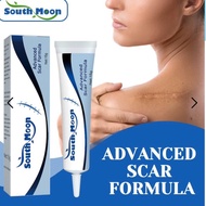 South moon US scar removal cream - Queenshop