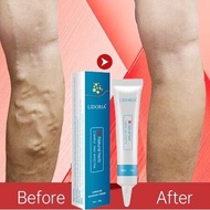 【Genuine Guarantee】 Varicose Vein Treatment Cream Spider Vein Pain Varicosity Effective Varicose Hea