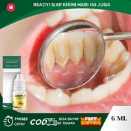 Obat Pembersih Karang Gigi Obat Tetes Perontok Karang Gigi Obat Perontok Karang Gigi Obat Perontok P