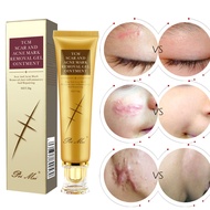 LADES【Ready In Stock】30Ml Women TCM Scar Cream Scald Surgical Scar Stretch Mark Repair Cream Treatment Whitening Cream Skin Repair Face Cream