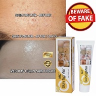 MD SKIN FIGHTER Healing Cream Skin Treatment Cream Itchy Soothing Relief Repair