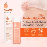 Bio-Oil Stretch Marks Oil/Acne/Scar Remover Scar Remover Uneven Skin cream 200ml