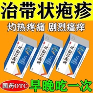 Medicine with Herpes Snake Wrapped Waist Simple Herpes Virus Infection Intensive Blister Pain Gentia