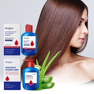 Hoegoa Selenium Sulfide Shampoo Deep Cleanses The Scalp Controls Oil And Anti-Dandruff Two Models120
