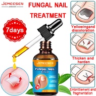 【Jemeesen】Nail polish Nail Fungus Treatment Nail Care ubat kuku kaki rosak nail fungus medicine fung