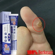 Medicine to remove warts, herpes, moles, cholesterol seeds, Mole Removal Wart Cream, Wart Removal Oi